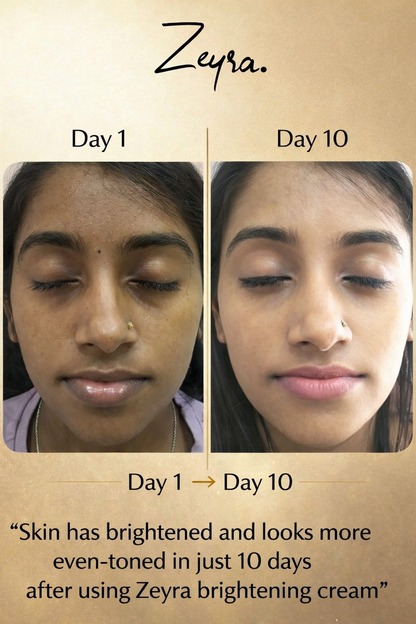 Zeyra Skin Brightening Cream - Bright,Smooth & Spot Free Skin