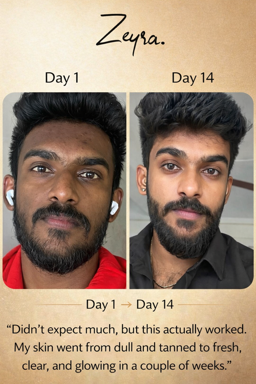 Zeyra Skin Brightening Cream - Bright,Smooth & Spot Free Skin