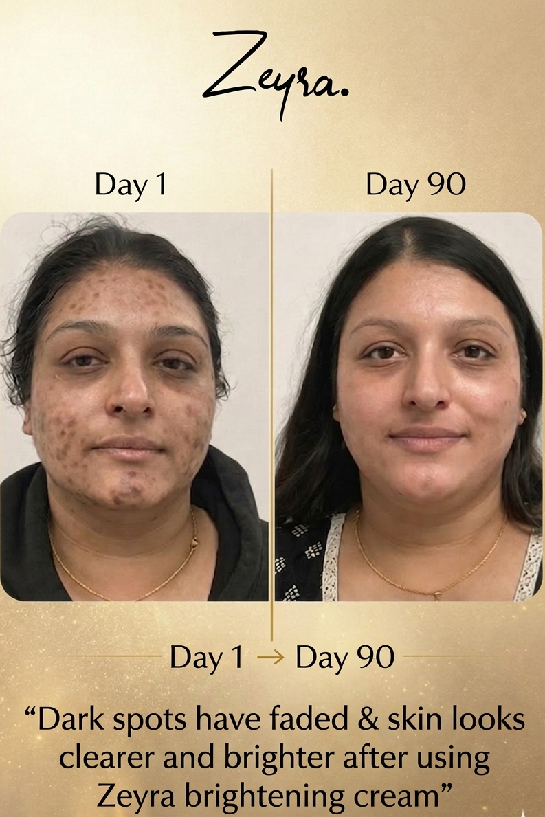 Zeyra Skin Brightening Cream - Bright,Smooth & Spot Free Skin