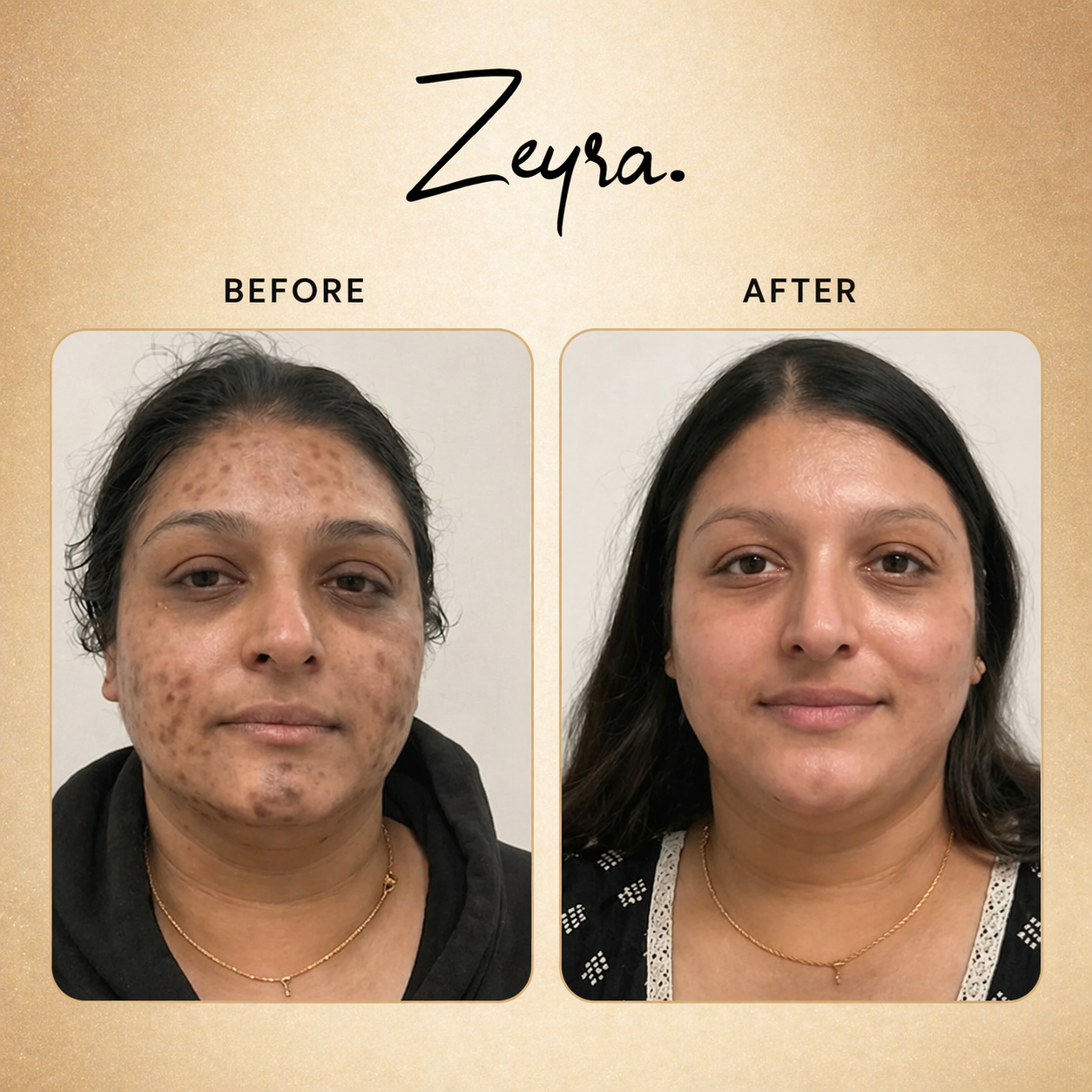 Zeyra Skin Brightening Cream for Dark Spots & Glowing Skin