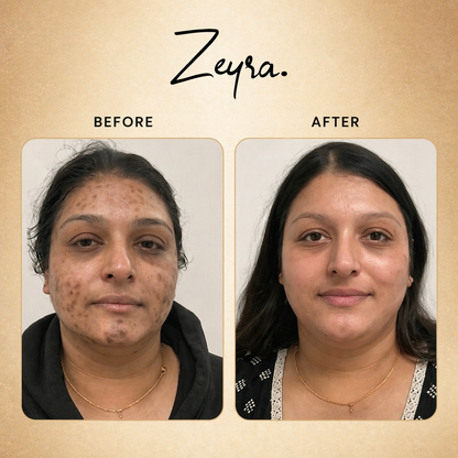 Zeyra Skin Brightening Cream for Dark Spots & Glowing Skin