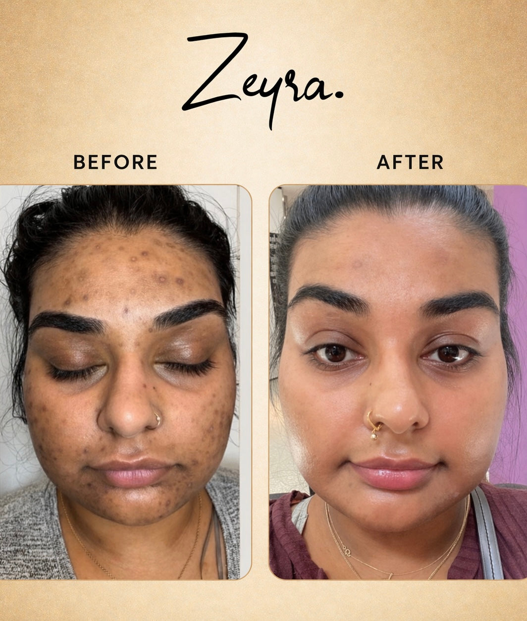 Zeyra Skin Brightening Cream for Dark Spots & Glowing Skin