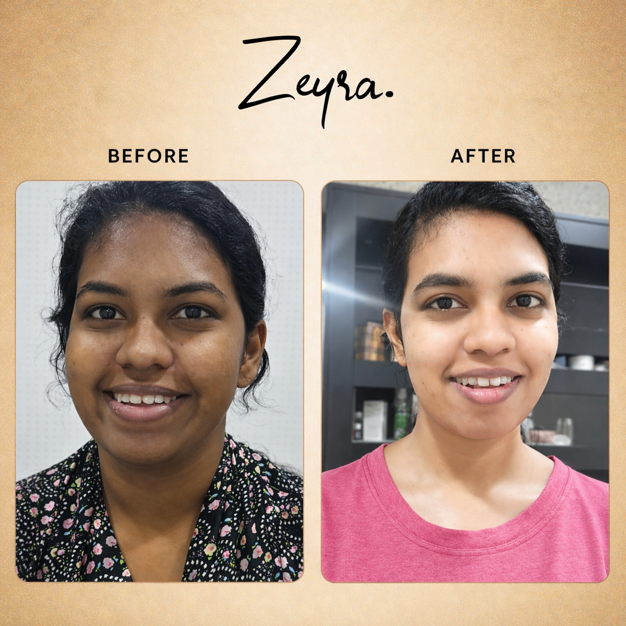 Zeyra Skin Brightening Cream for Dark Spots & Glowing Skin