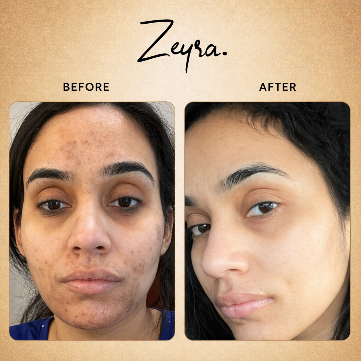 Zeyra Skin Brightening Cream for Dark Spots & Glowing Skin