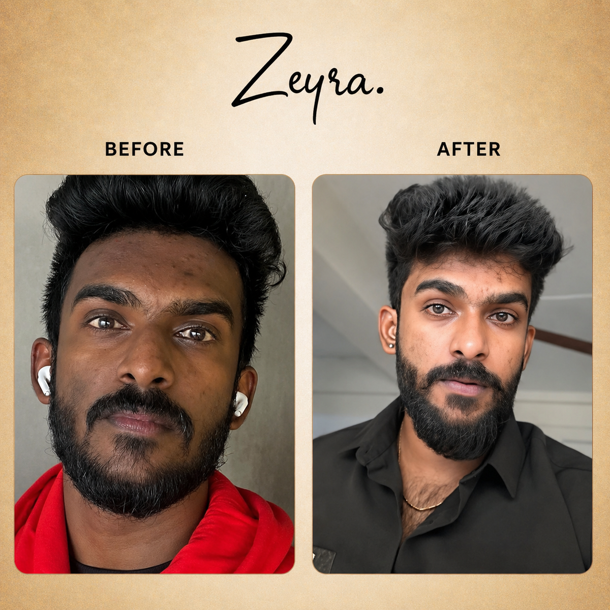 Zeyra Skin Brightening Cream for Dark Spots & Glowing Skin