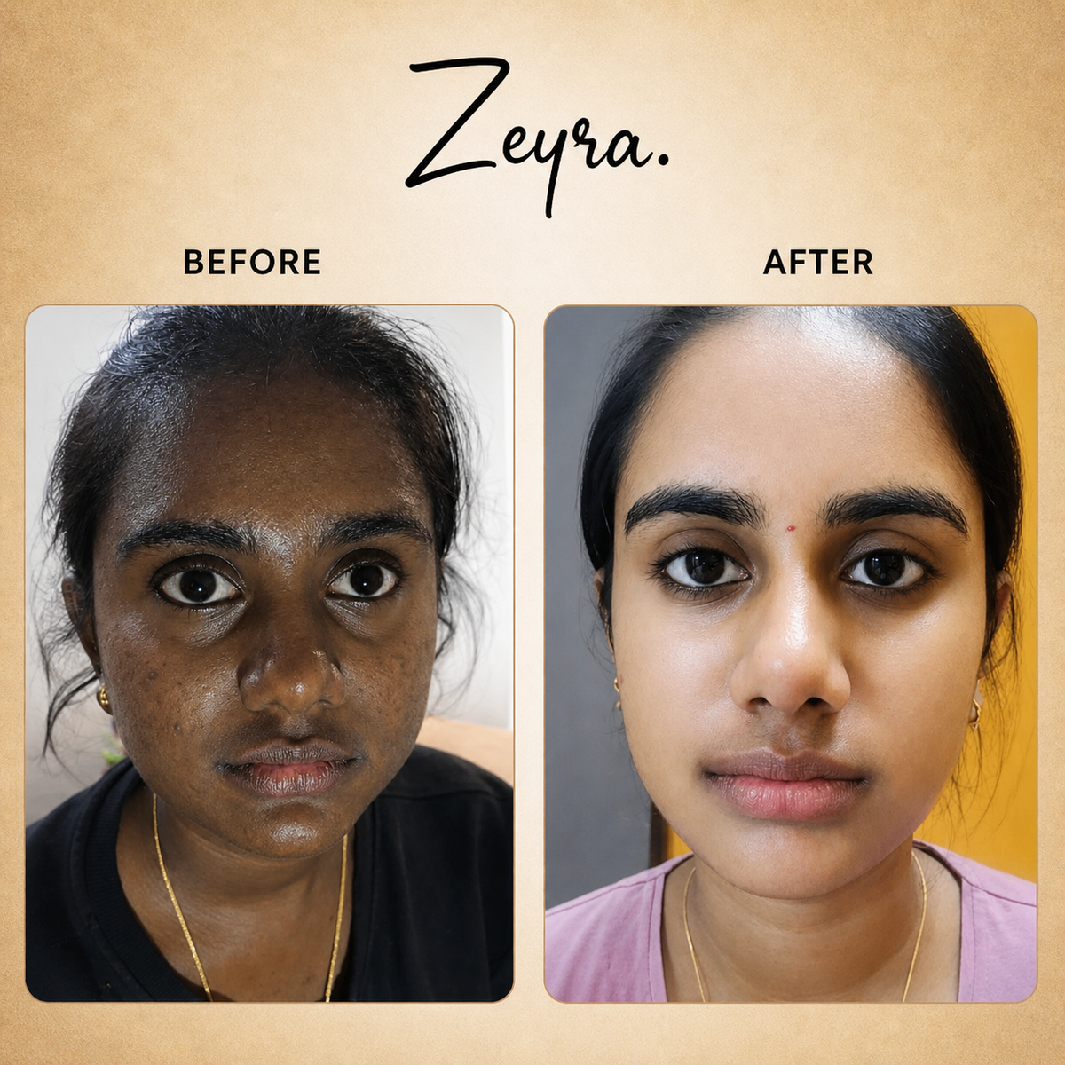 Zeyra Skin Brightening Cream for Dark Spots & Glowing Skin