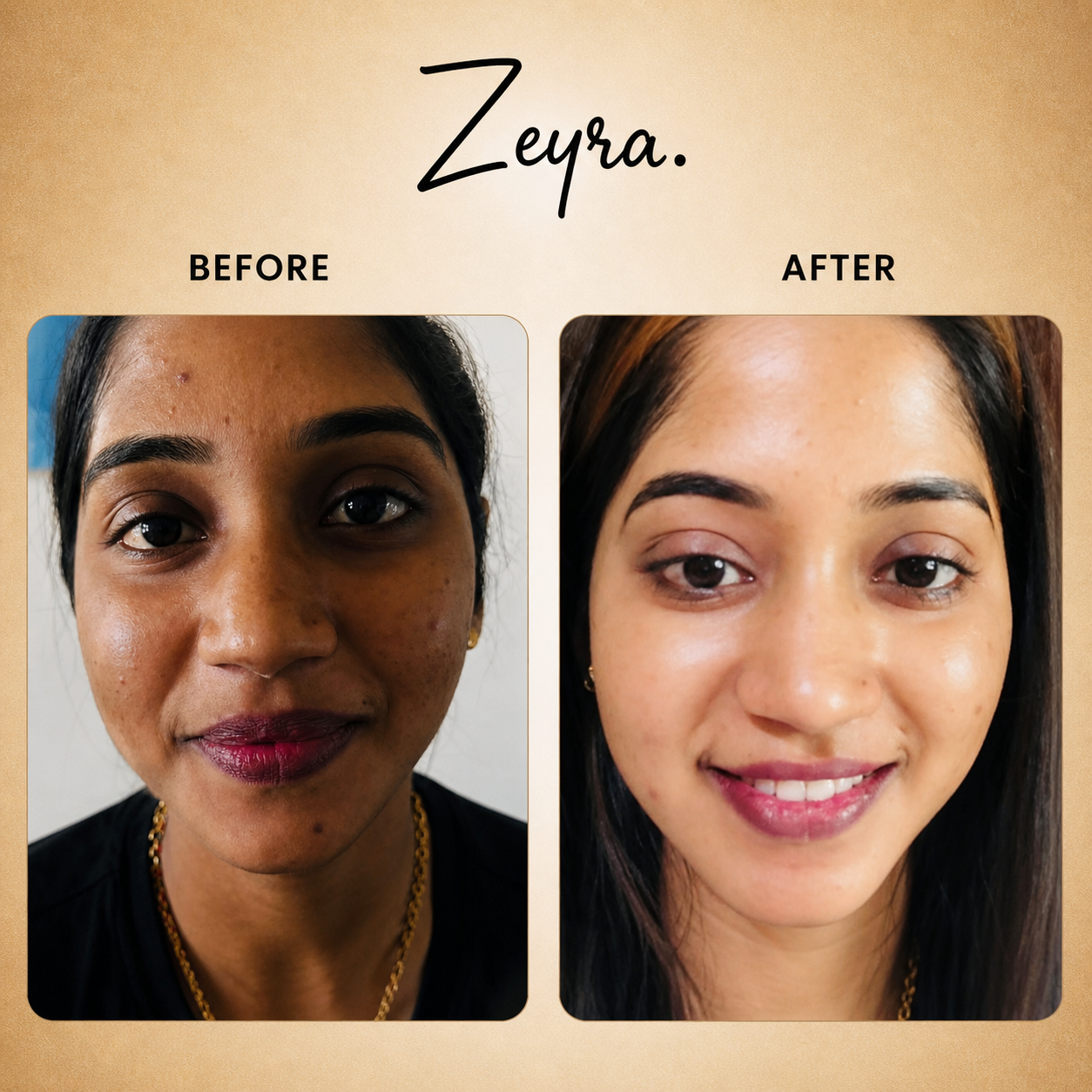Zeyra Skin Brightening Cream for Dark Spots & Glowing Skin