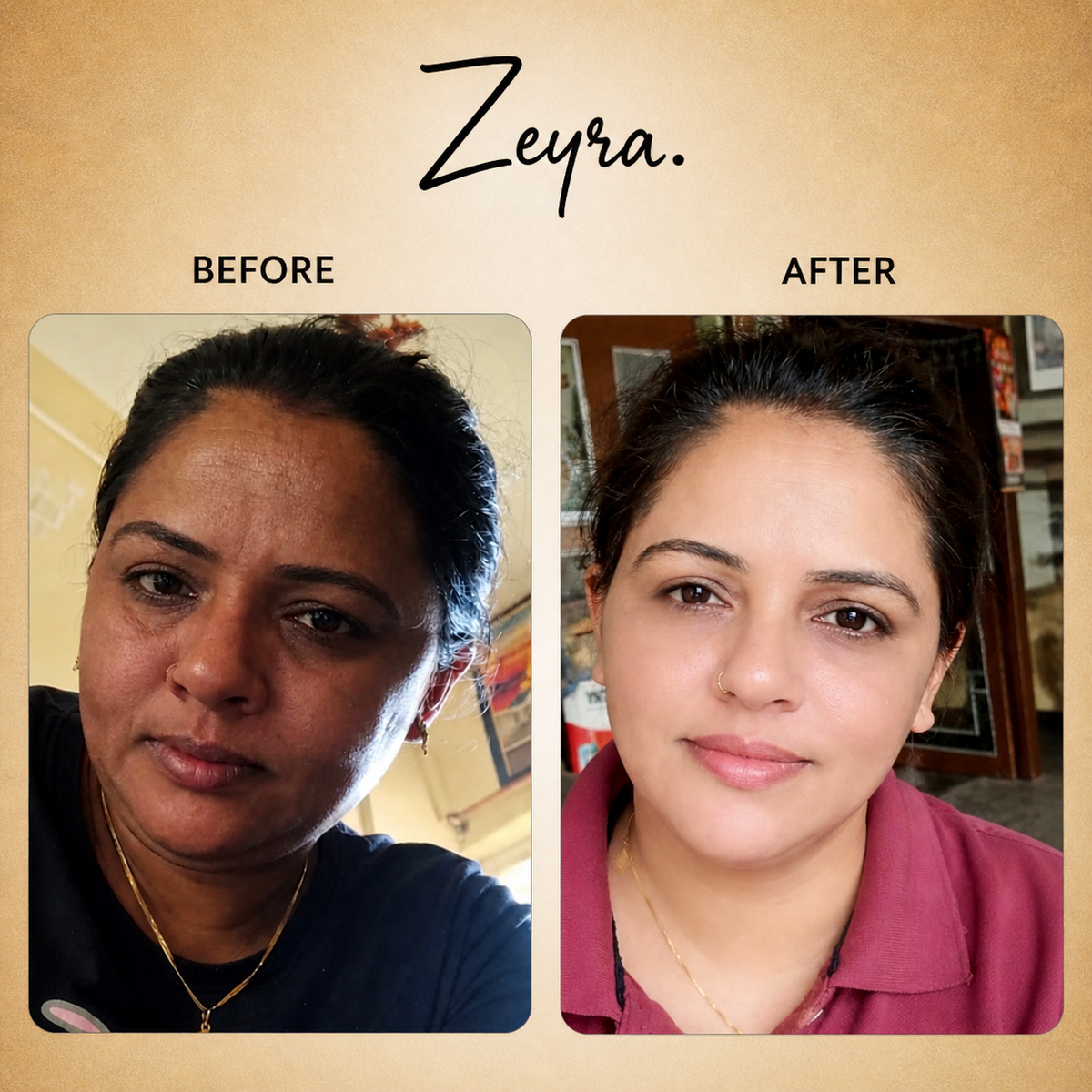 Zeyra Skin Brightening Cream for Dark Spots & Glowing Skin