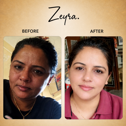 Zeyra Skin Brightening Cream for Dark Spots & Glowing Skin