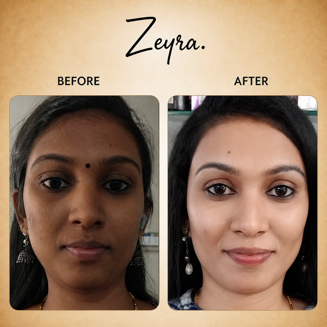 Zeyra Skin Brightening Cream for Dark Spots & Glowing Skin